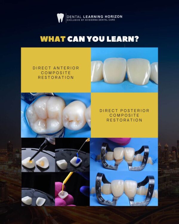 [Dubai Edition] Direct & Indirect Restorative Masterclass - Image 2