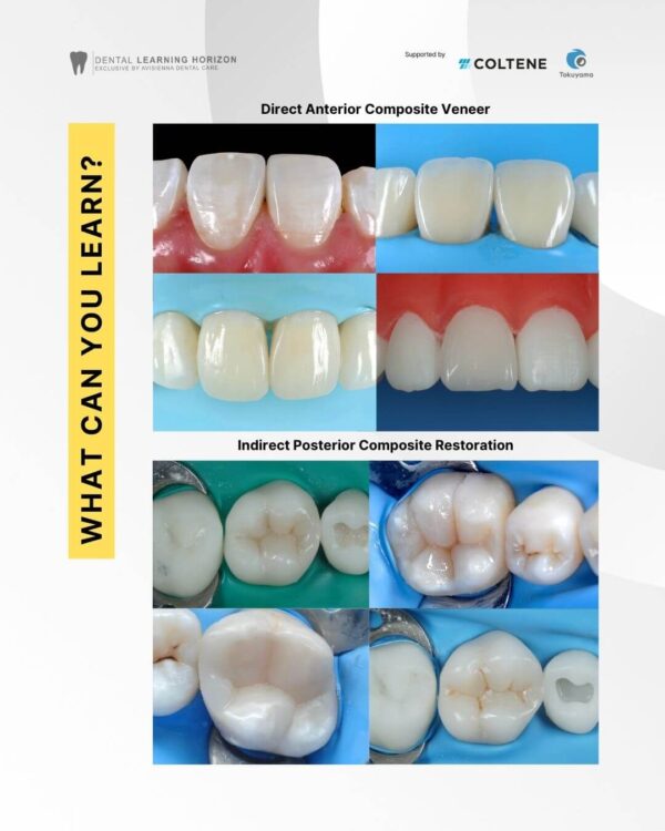 Mastering the Art of Direct Restoration - Image 2